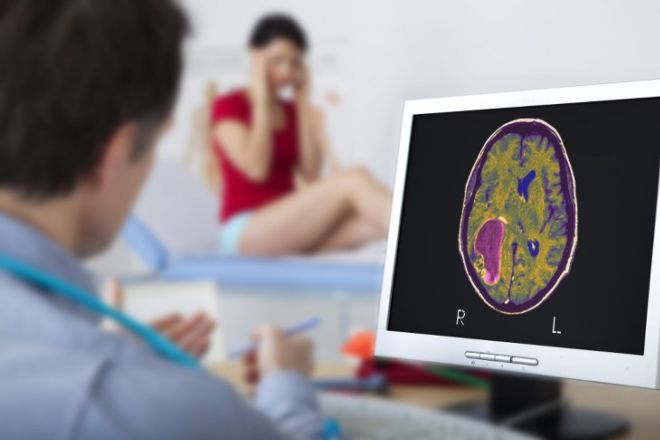 Understanding The 7 Important Symptoms Of A Brain Tumor