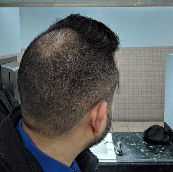 34 Ridiculously Terrible Haircuts Of The Year