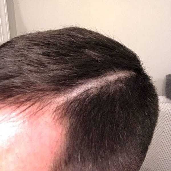 34 Ridiculously Terrible Haircuts Of The Year