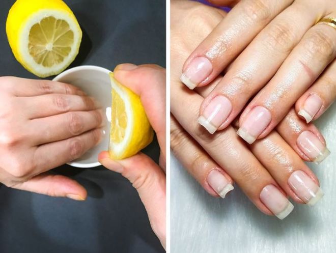 10 Ways That Can Help You Treat Brittle Nails