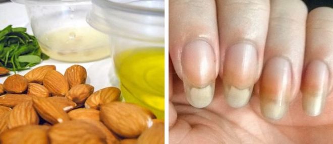 10 Ways That Can Help You Treat Brittle Nails
