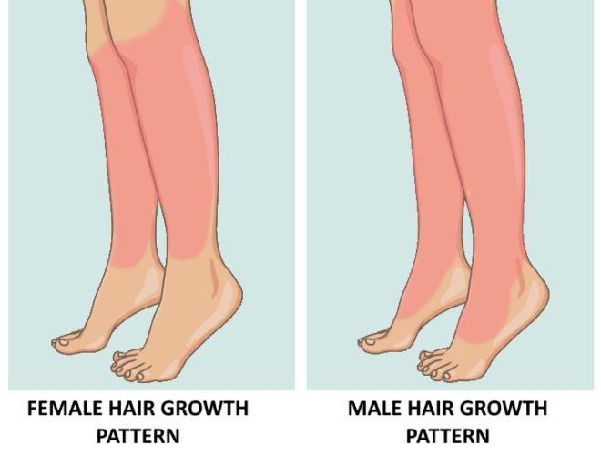 excess-hair-growth-in-women-is-a-symptom-you-shouldn-t-ignore